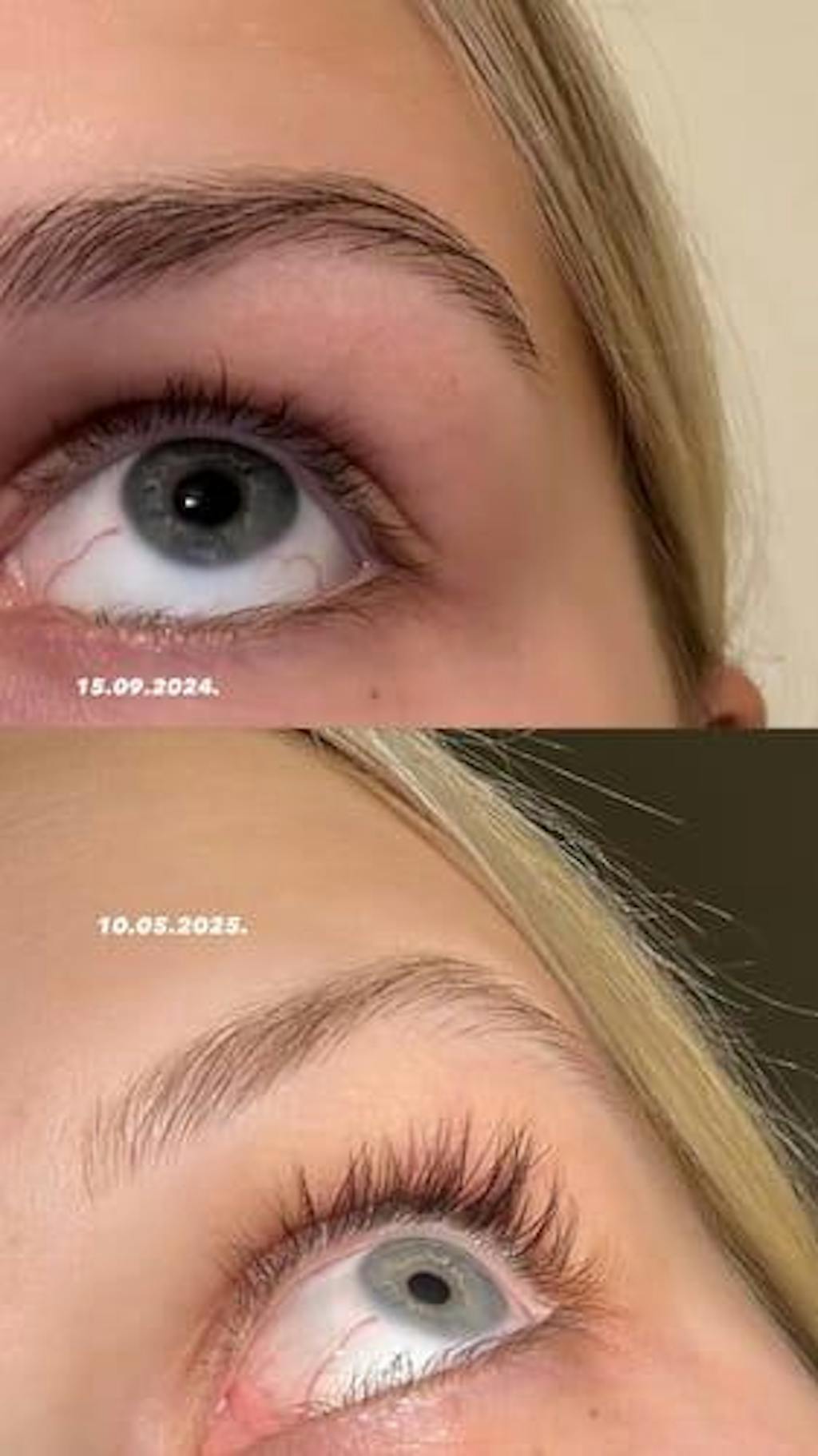 Skropstu Augšanas Serums