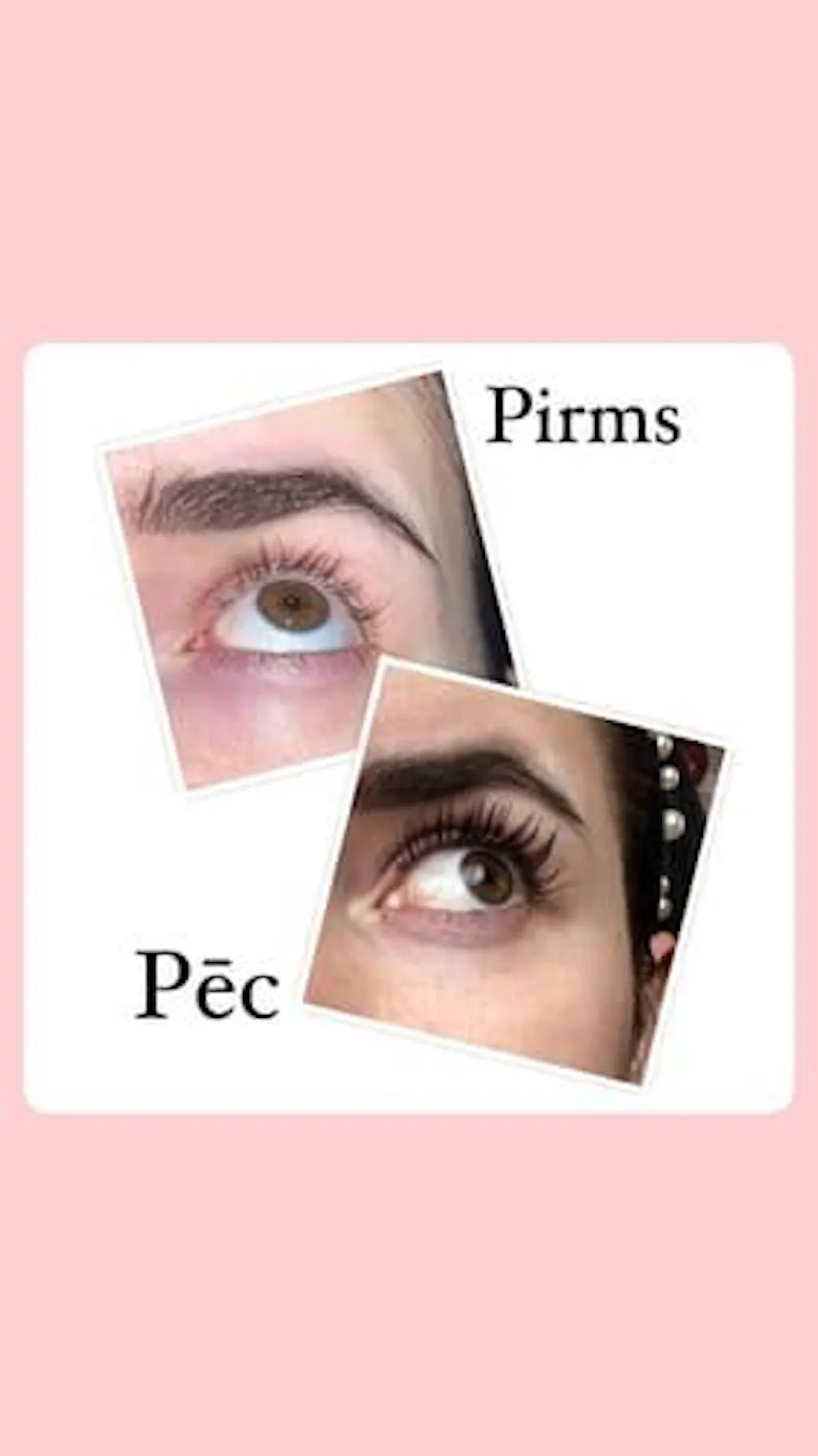 Skropstu Augšanas Serums