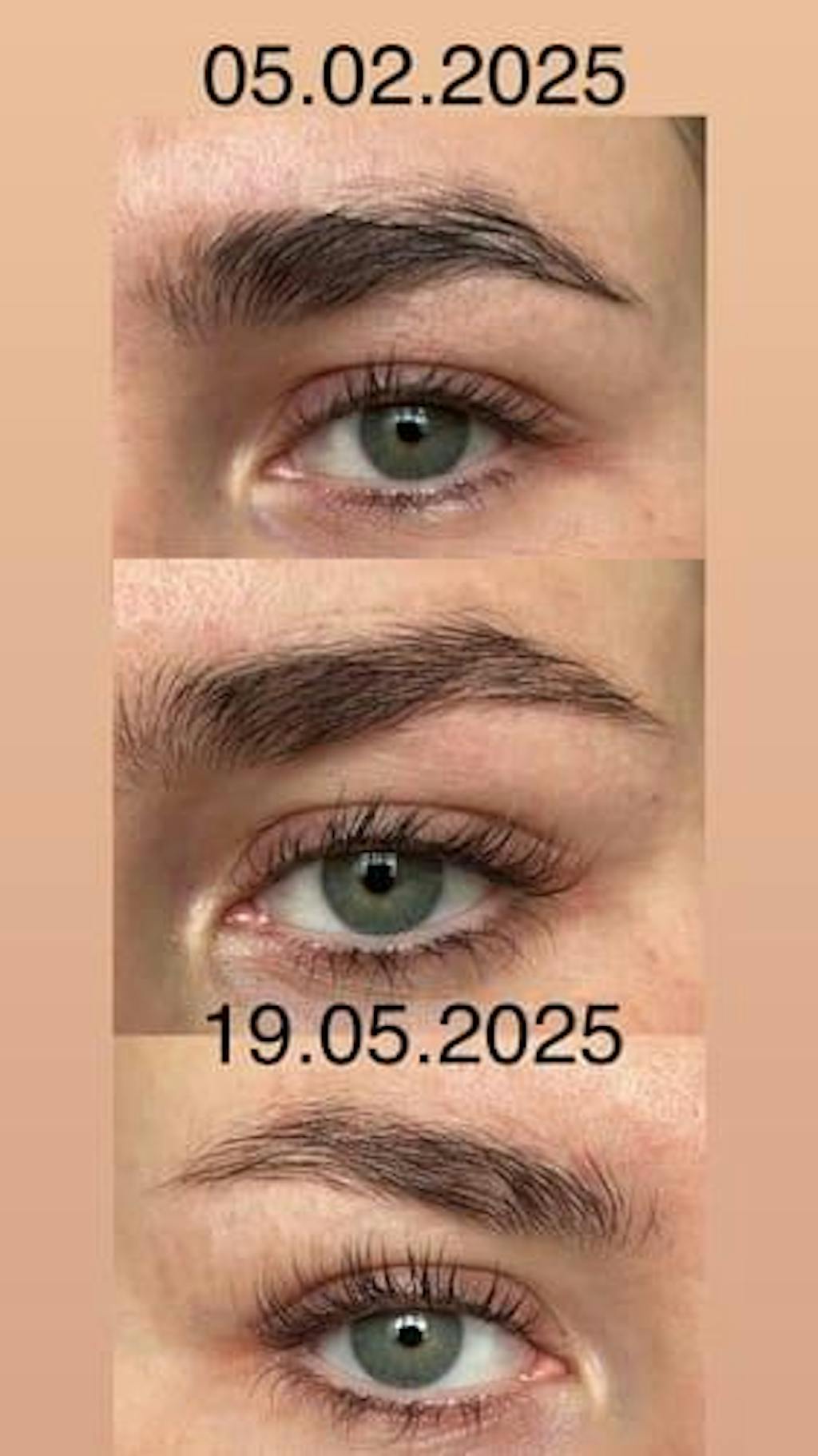 Skropstu Augšanas Serums