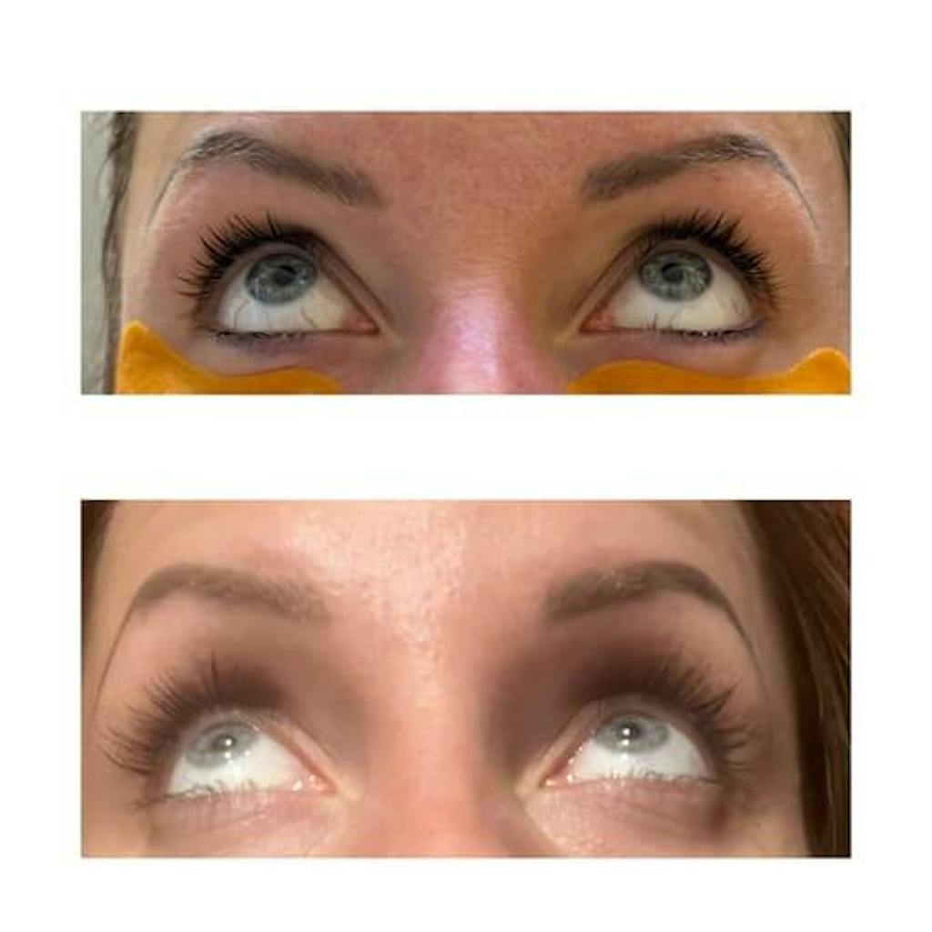 Skropstu Augšanas Serums