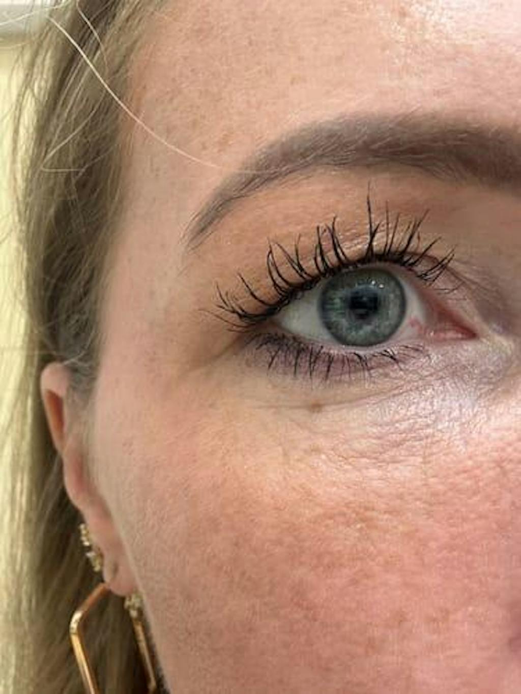 Skropstu Augšanas Serums