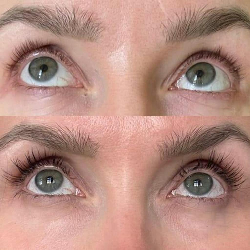 Skropstu Augšanas Serums