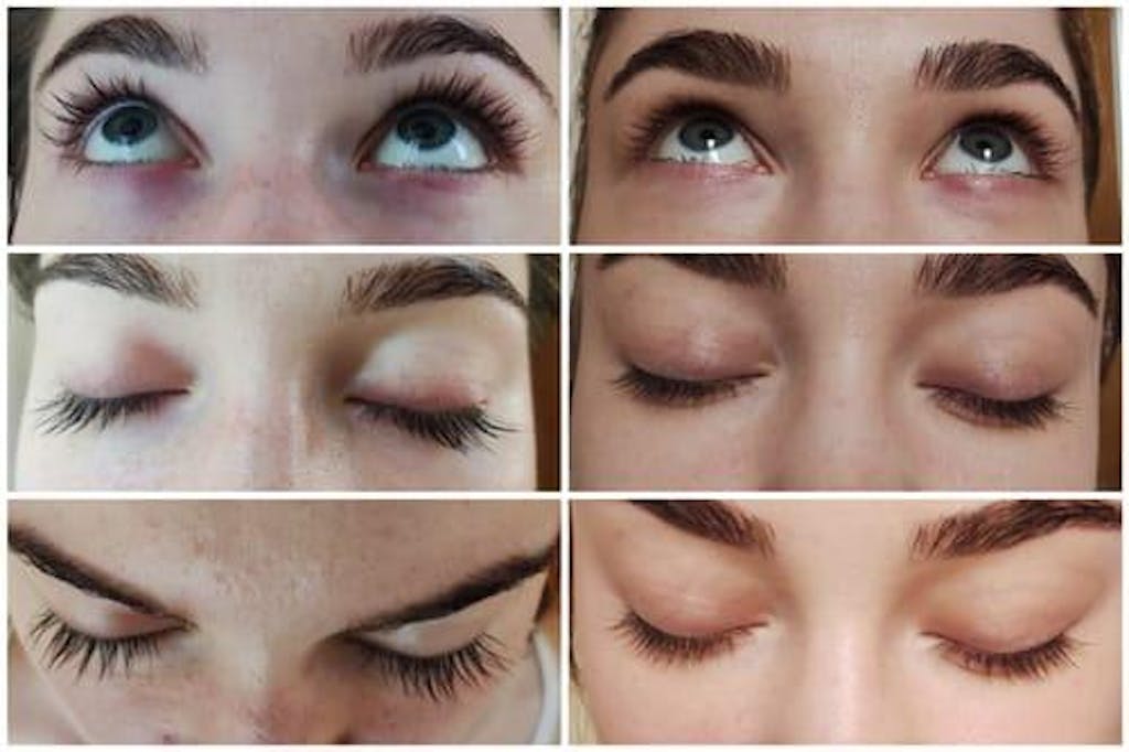 Skropstu Augšanas Serums