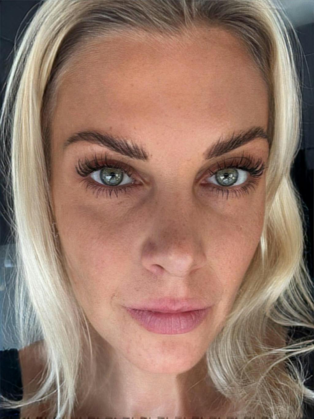 Skropstu Augšanas Serums