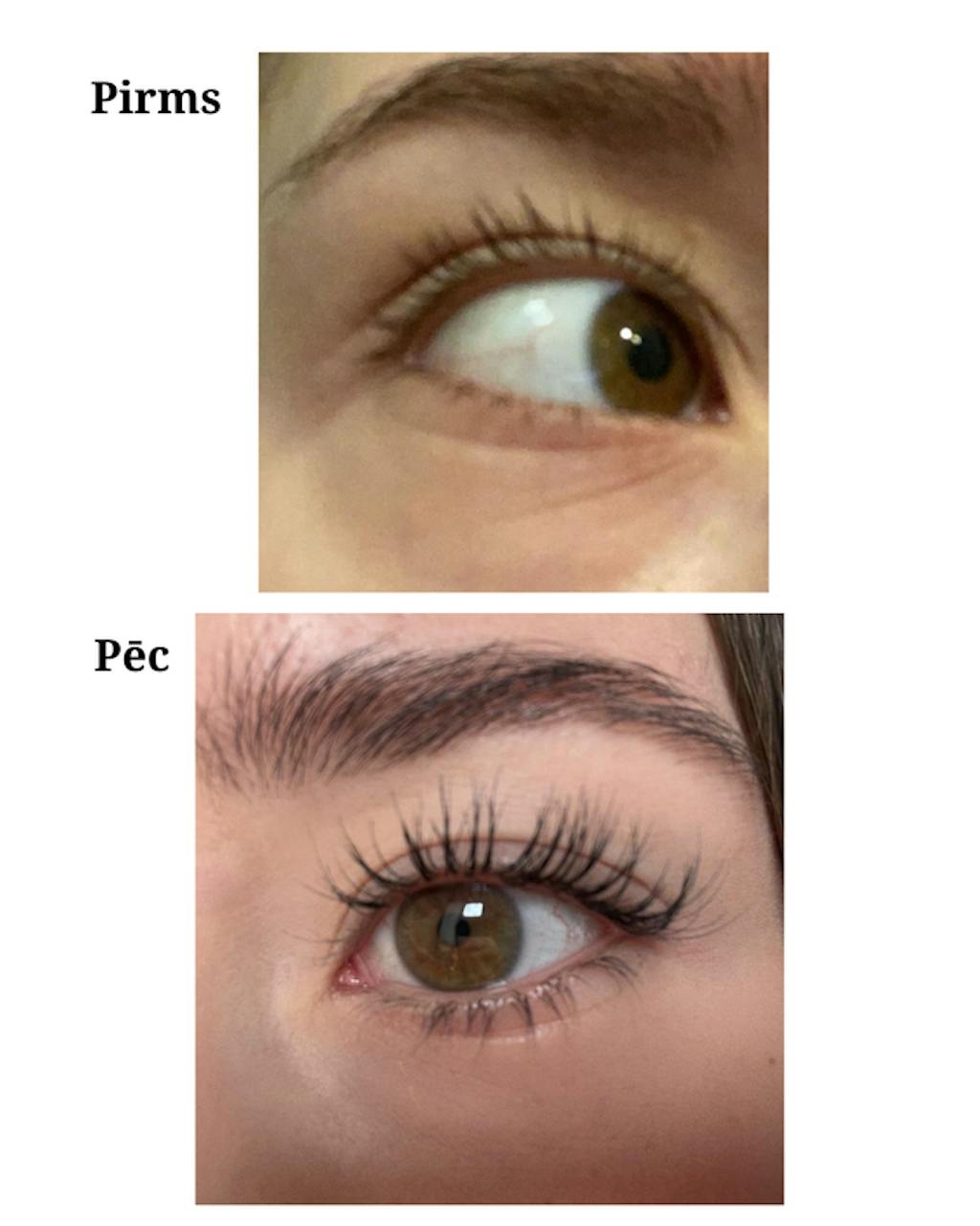 Skropstu Augšanas Serums