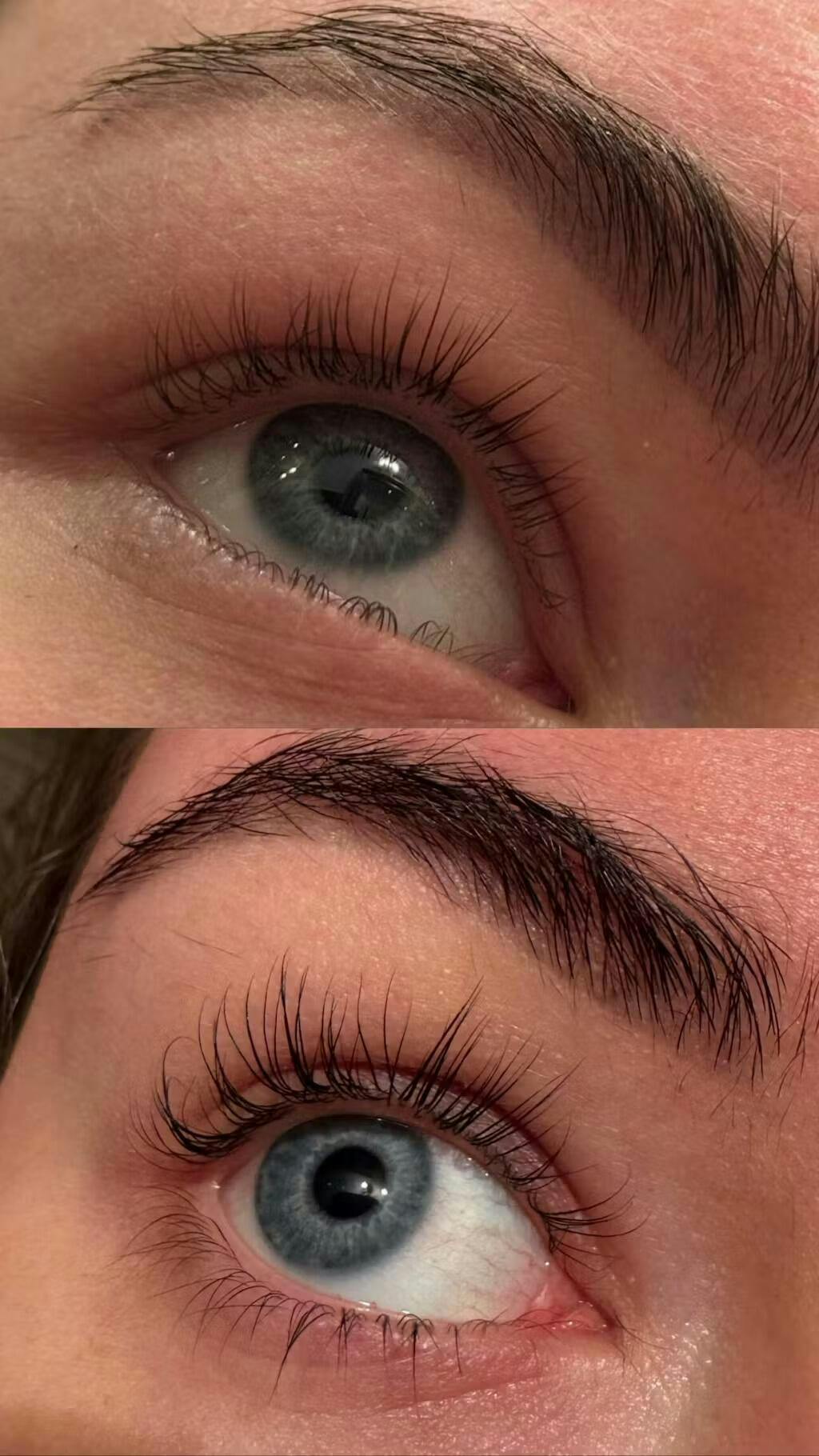 Skropstu Augšanas Serums