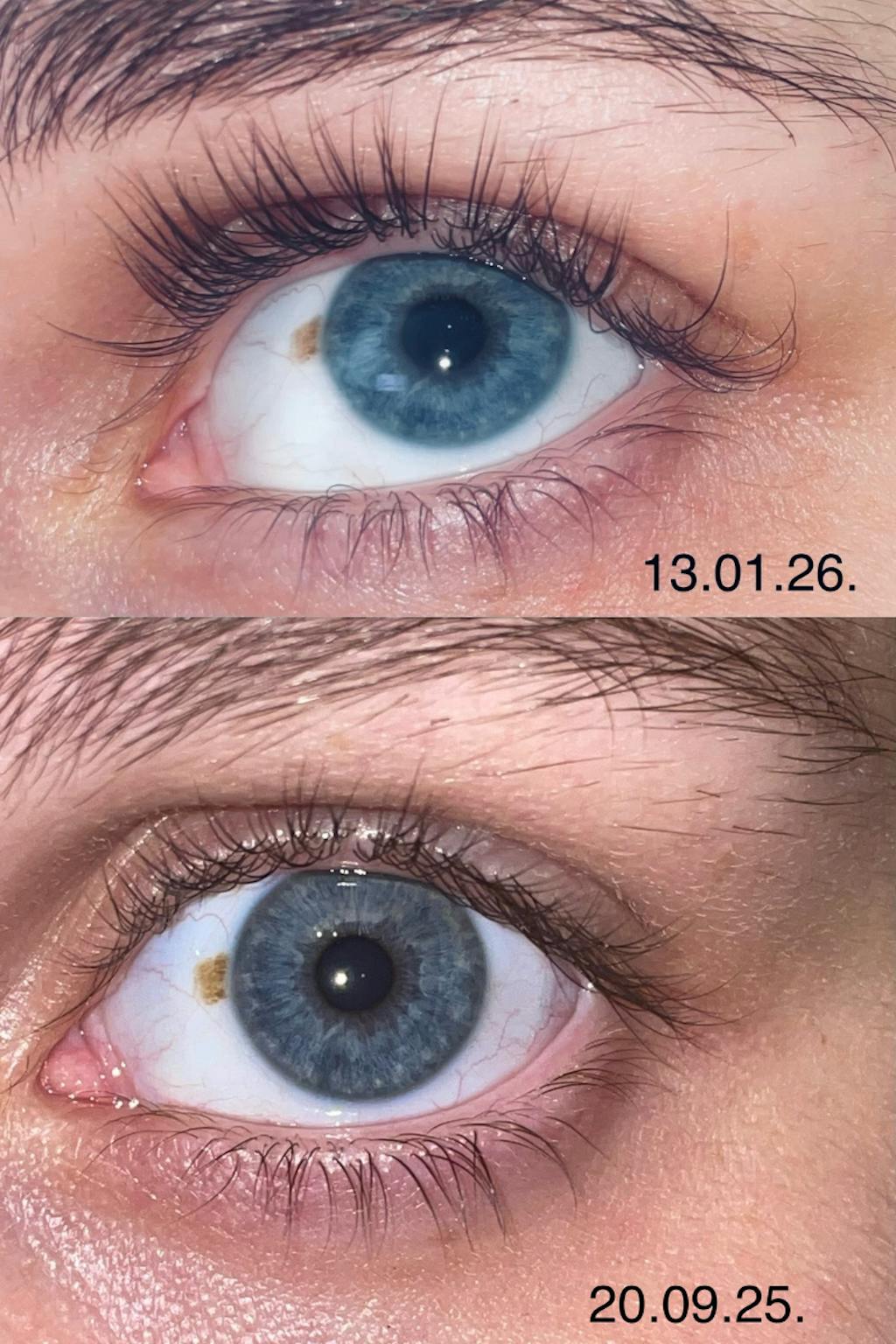 Skropstu Augšanas Serums