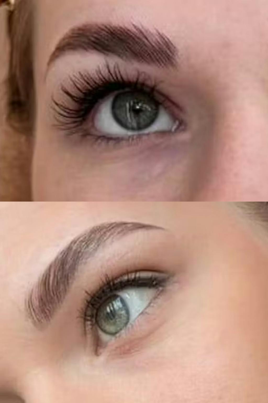 Skropstu Augšanas Serums