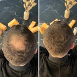 Relleno de densidad capilar