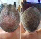 Relleno de densidad capilar