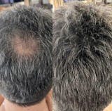 Relleno de densidad capilar