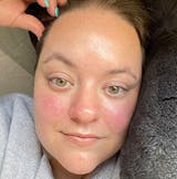 Parches oculares de colágeno y PDRN InstaLift