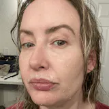 Peel Shot Coréen - Élimine les Impuretés et Sublime Votre Peau