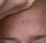 Peel Shot Coréen - Élimine les Impuretés et Sublime Votre Peau