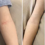 Baby Lotion