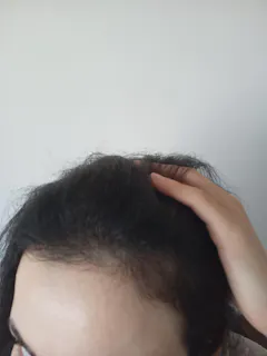 Review picture