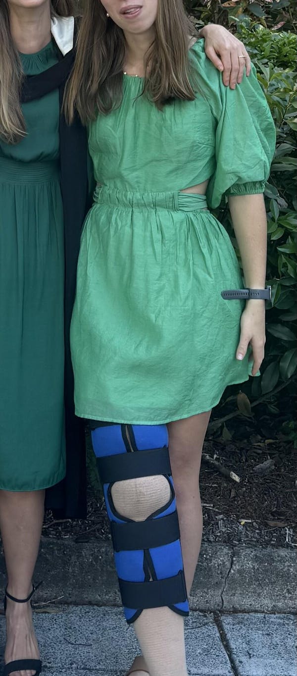 Diane Mini Dress - Green