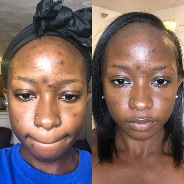 Glow Skin Brightening Facial Scrub