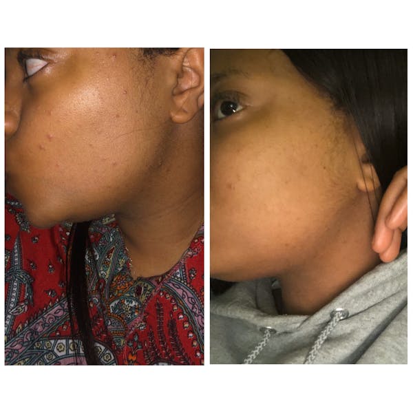 Glow Skin Brightening Face Scrub + Scrubbie Combo