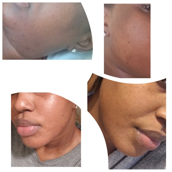 Glow Skin Brightening Facial Scrub