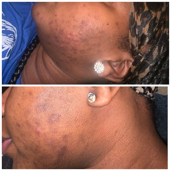 Lumen Serum Dark Spot Corrector