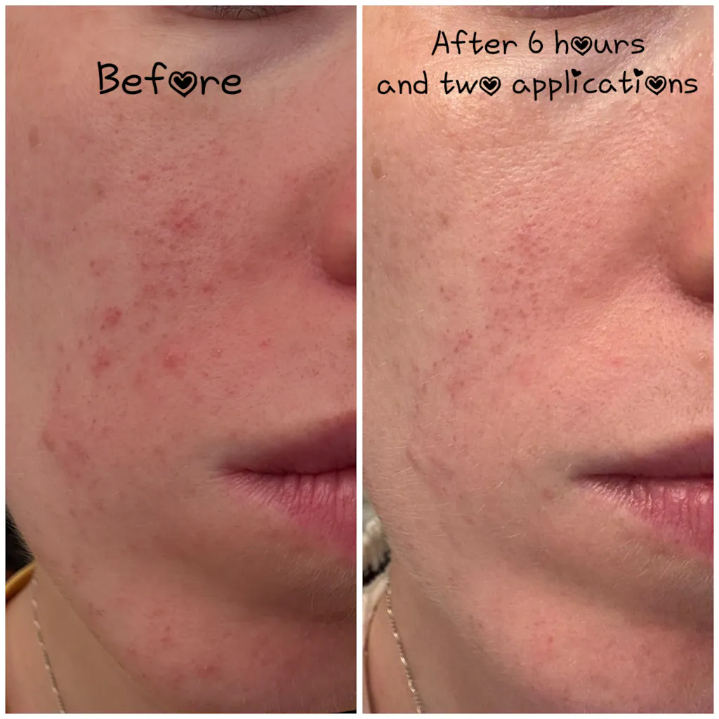 Products – MyMagicHealer