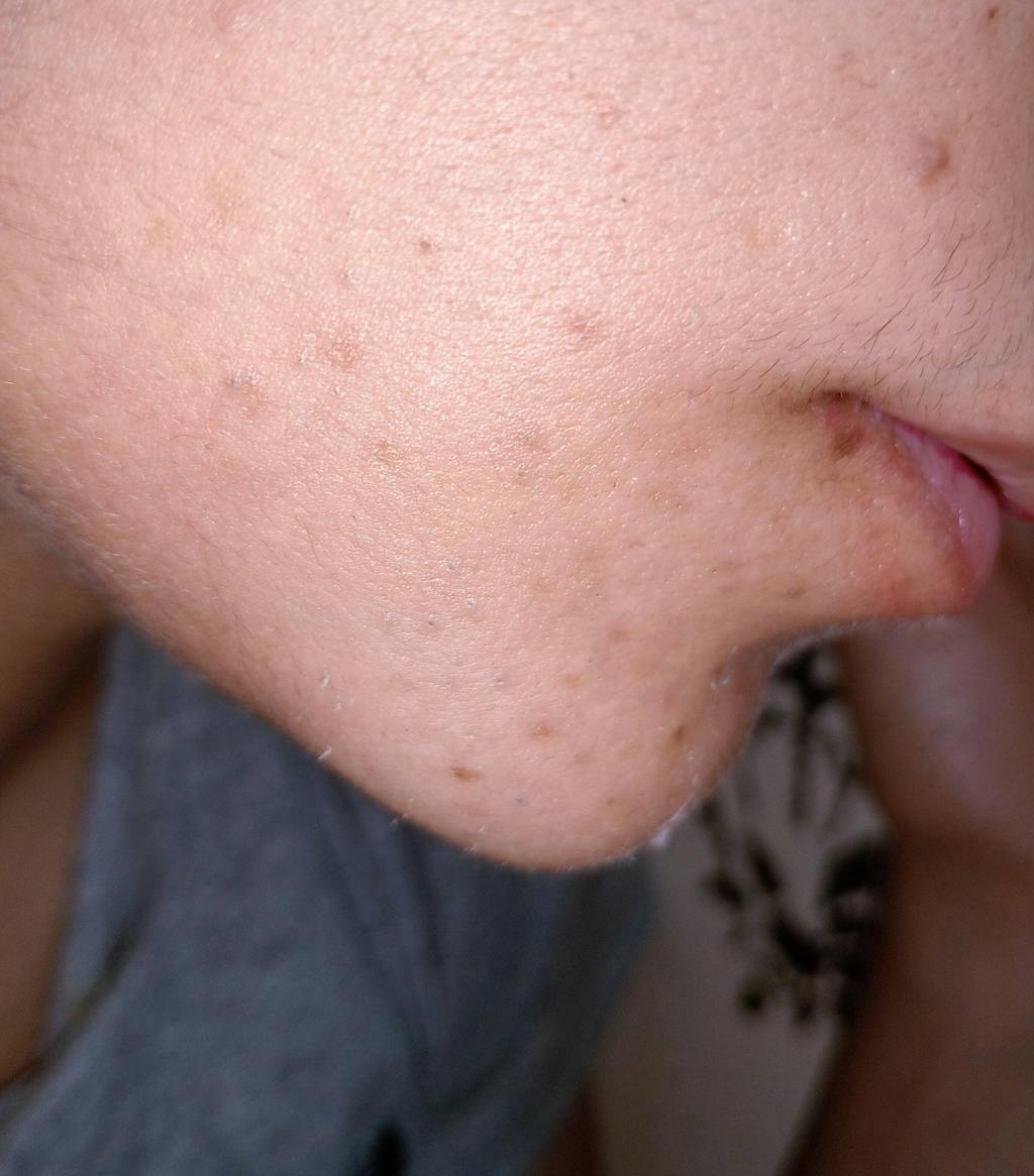 Vitamin C 10% (L-Ascorbic Acid)