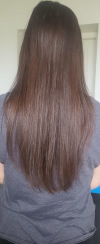 Neige d’été ®  | Soin avant-shampoing