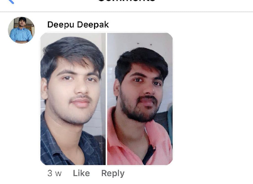 Lip Serum Oil Natural Balm To Get Pink Lips For Girls And Women