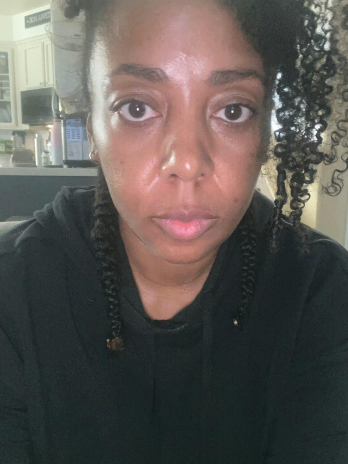 NIRA Pro Laser | At-Home Laser Device for Full Wrinkle Reduction