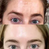 KIT TRATAMIENTO - MANCHAS + GRANITOS + IMPERFECCIONES