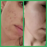 GGLOW Exfoliante - 5% Ácido Glicólico & Niacinamida