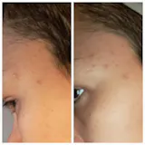 RUTINA AM&PM - GRANITOS + MARCAS + POROS + MANCHAS + ARRUGAS