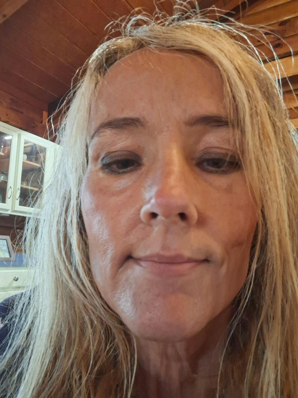 NourishMax Best Instant Lip Plumper [Bigger Lips AnyTime]