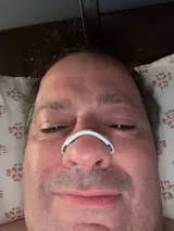 UP Life - Dilatador Nasal