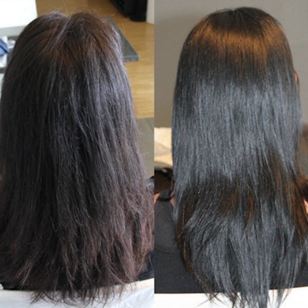 DeepSmooth® Lissage Absolu