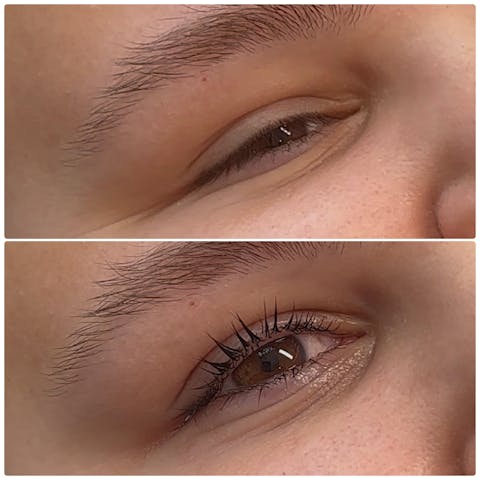 Fix 2 (Fix + Tint) Lotion 1x10ml