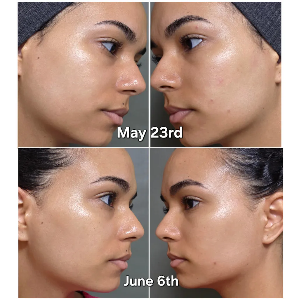 No.3 Blue Bio-Retinol Pore Refining Serum