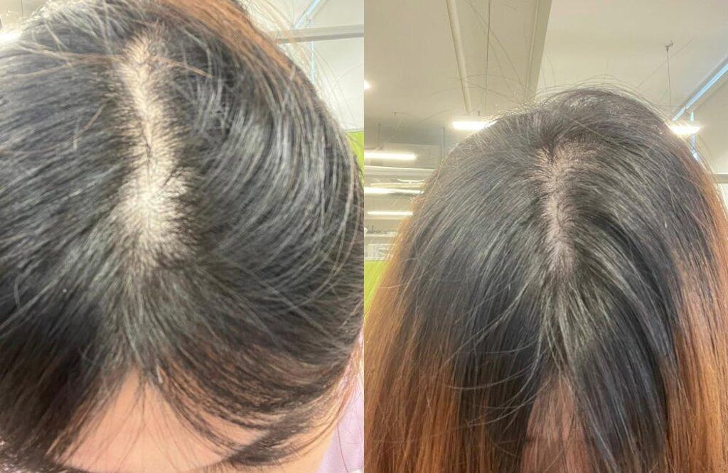 Nutra365 Hair Boost 60s – Support Healthy Hair Follicles & Scalp, Nourish & Hydrate Hair