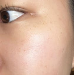 [Set] Intense Boost A Hydrating + B1 Luminous + B2 Nourishing