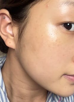 [Set] Intense Boost A Hydrating + B1 Luminous + B2 Nourishing