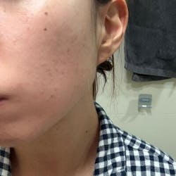 [Set] Intense Boost A Hydrating + B1 Luminous