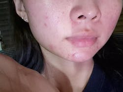 [Set] Intense Boost A Hydrating + B1 Luminous