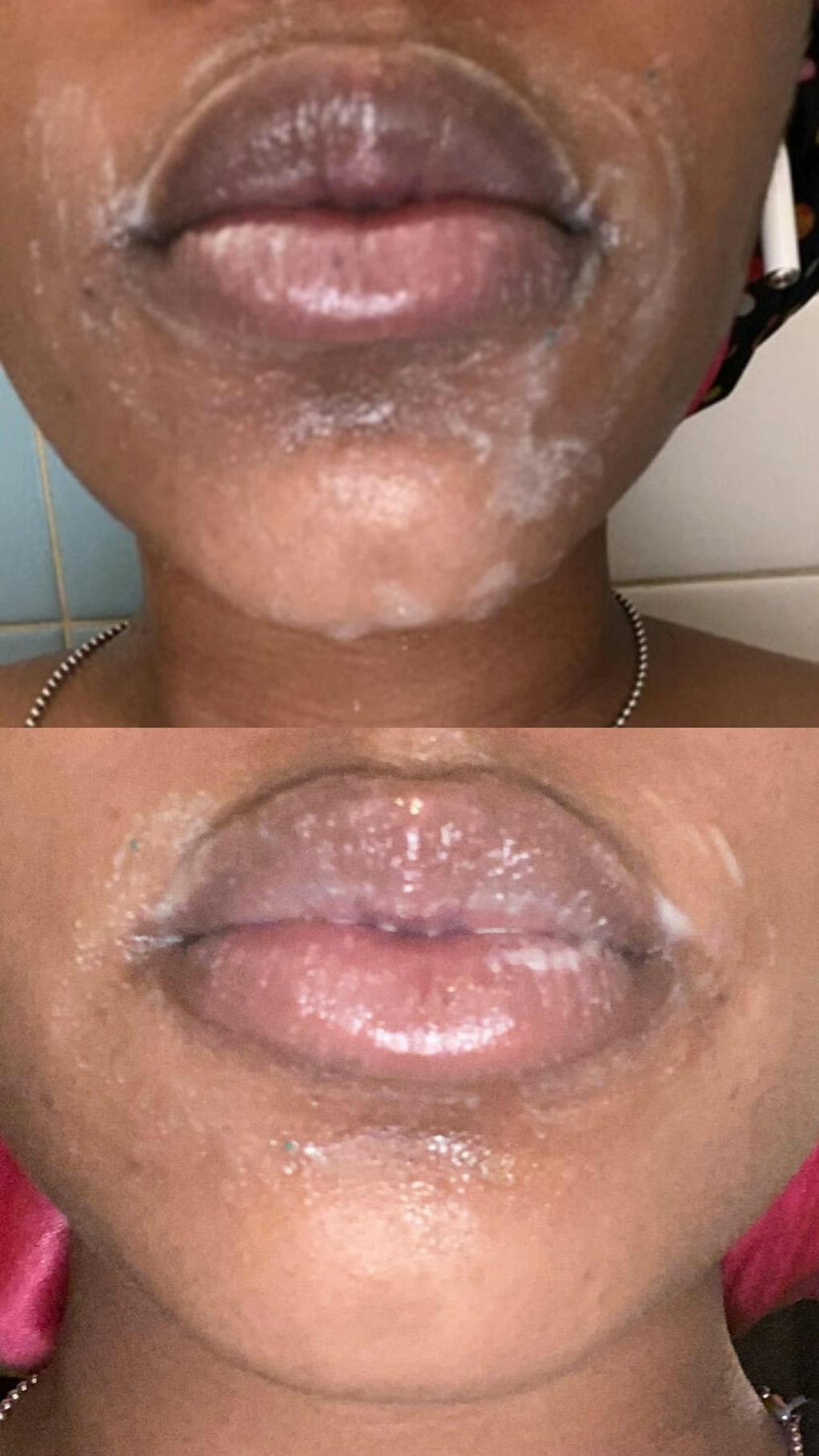 Lip Lightening Scrub Lip Exfoliator & Moisturizer With Kojic Acid OMORFEE