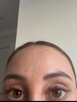 Eyelash Growth Serum