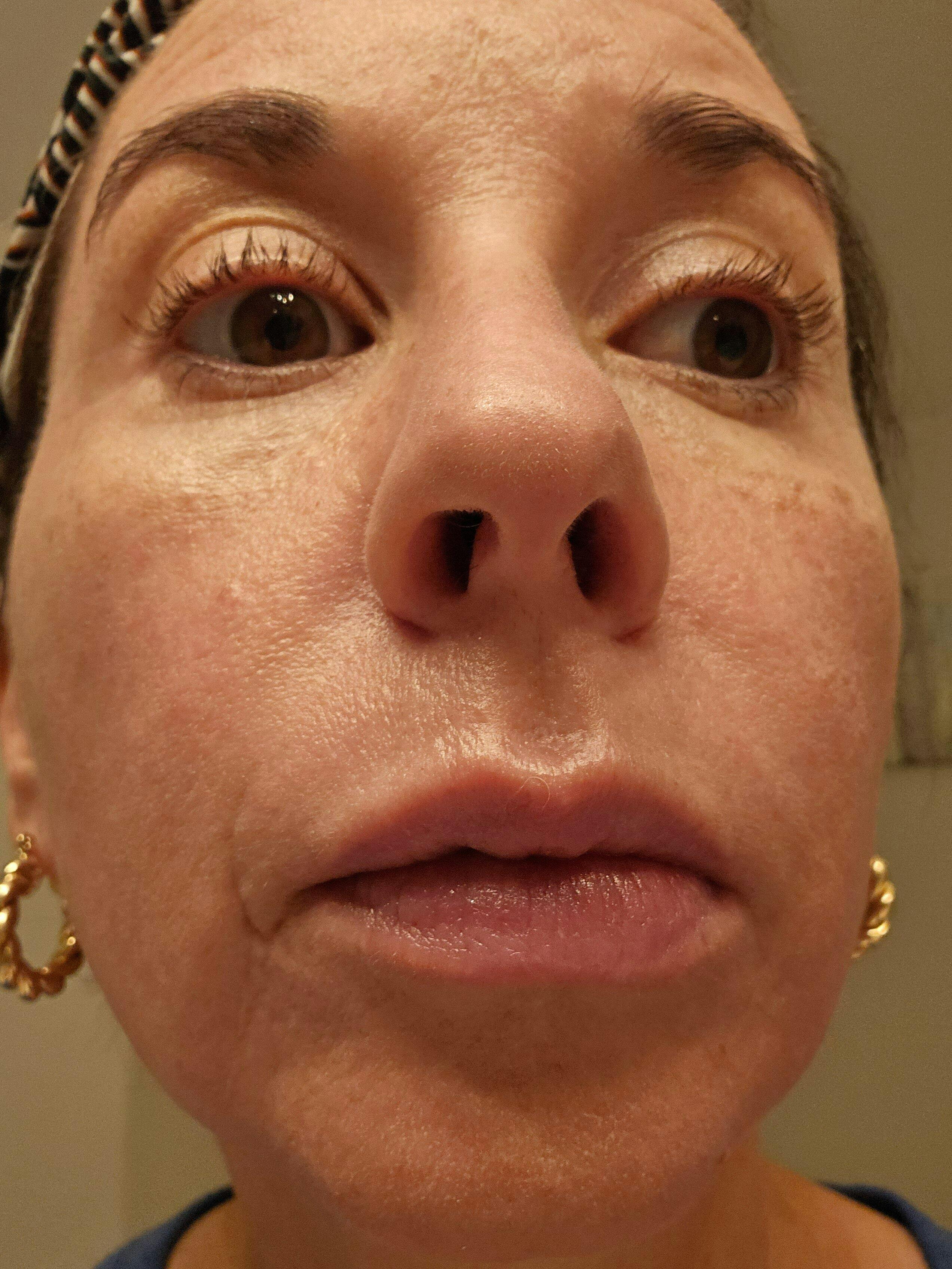 The Balm Lip Remedy – Nourishing Lip Treatment | Onekind
