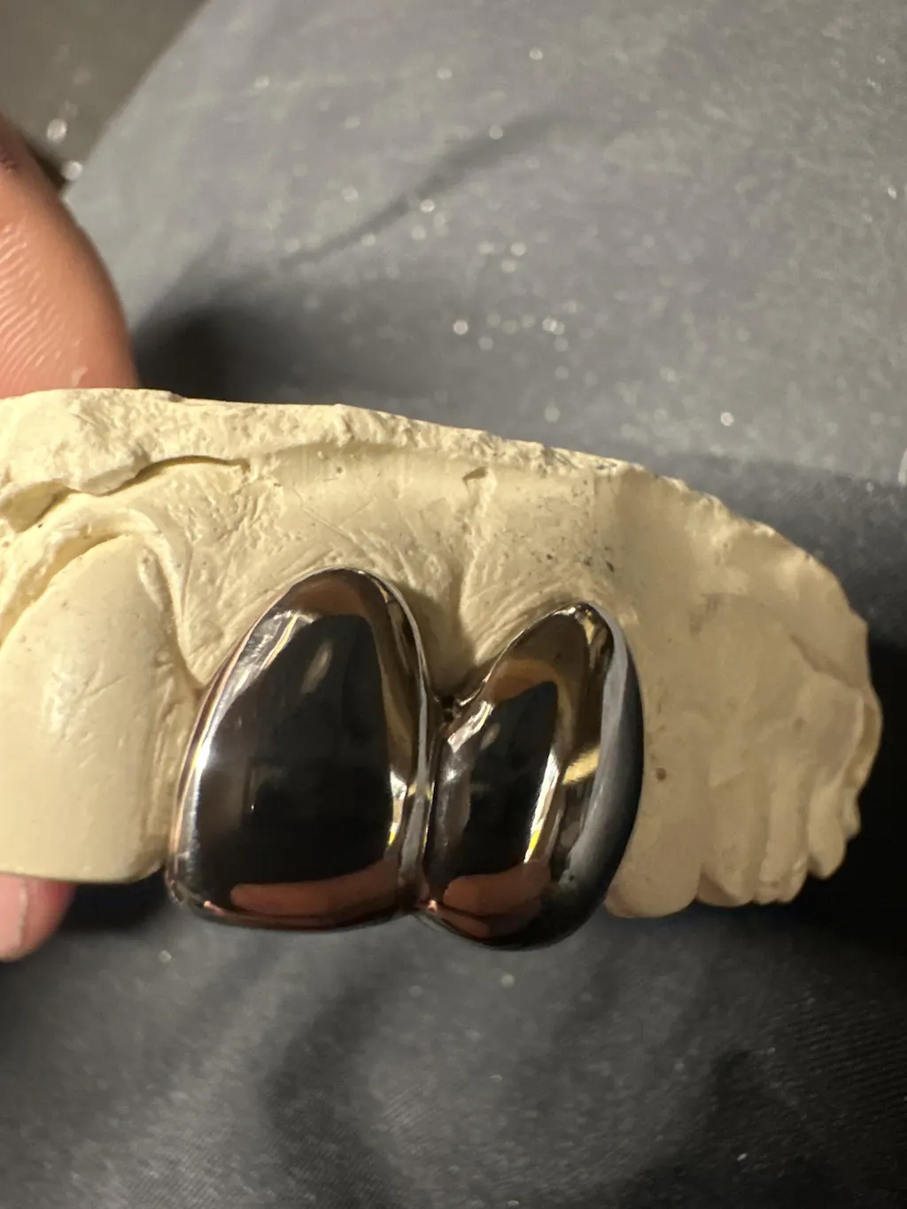 2-Tooth Dental Silver Caps | Custom Grillz UK | Onyx Grillz