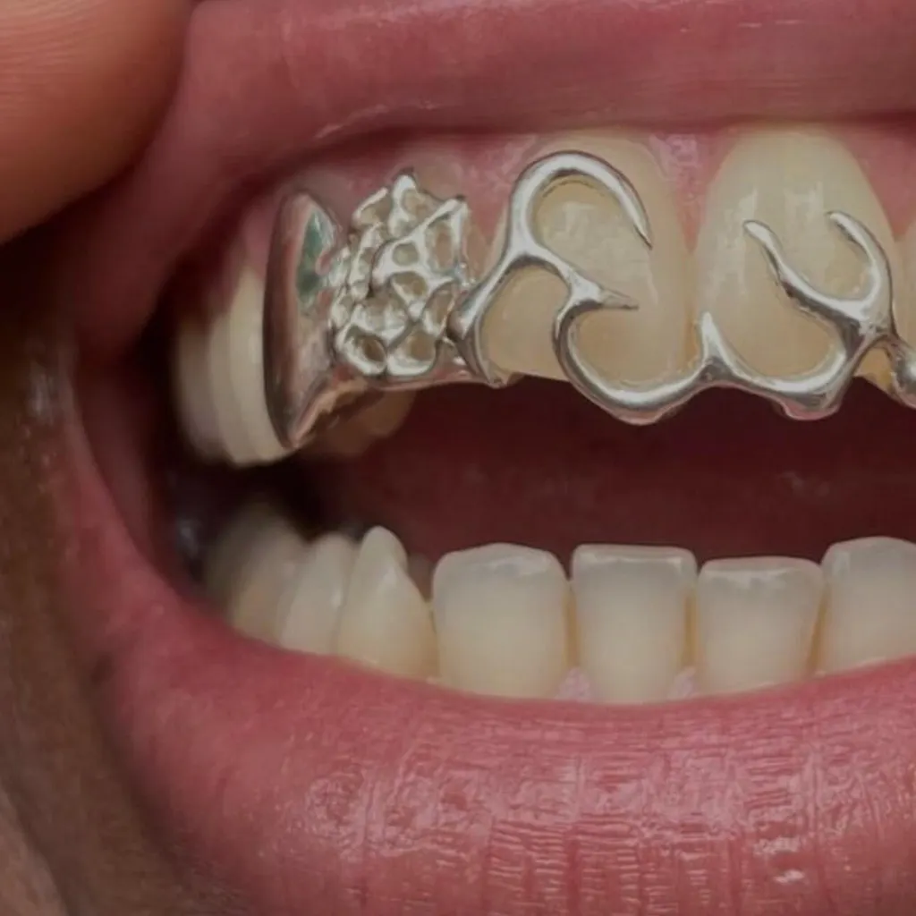 2-Tooth Dental Silver Caps | Custom Grillz UK | Onyx Grillz