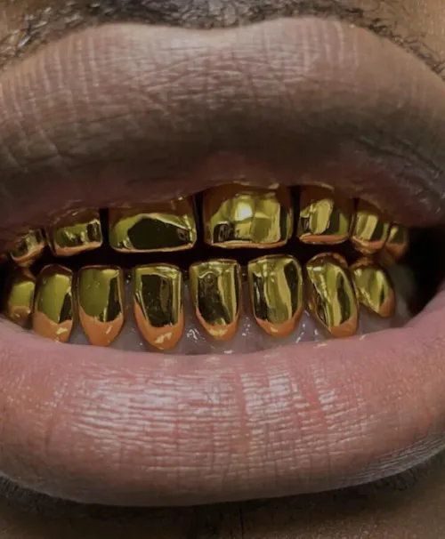 2-Tooth Dental Silver Caps | Custom Grillz UK | Onyx Grillz