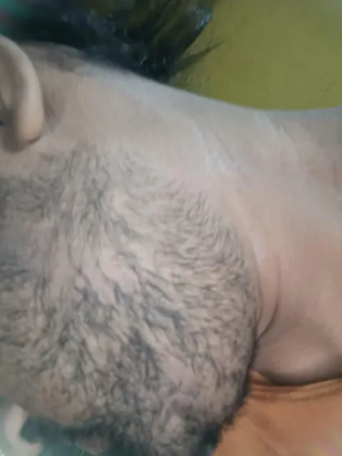 Advanced Ayurvedic Formula for Alopecia Treatment | Doctor Recommended | 100% Safe & Effective